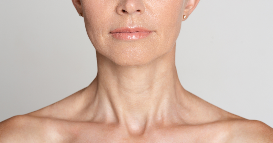 Close-up of a woman’s smooth and youthful neck after Dysport treatment, highlighting a rejuvenated appearance.